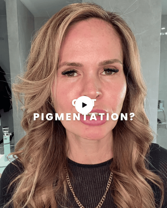 Do you have pigmentation?