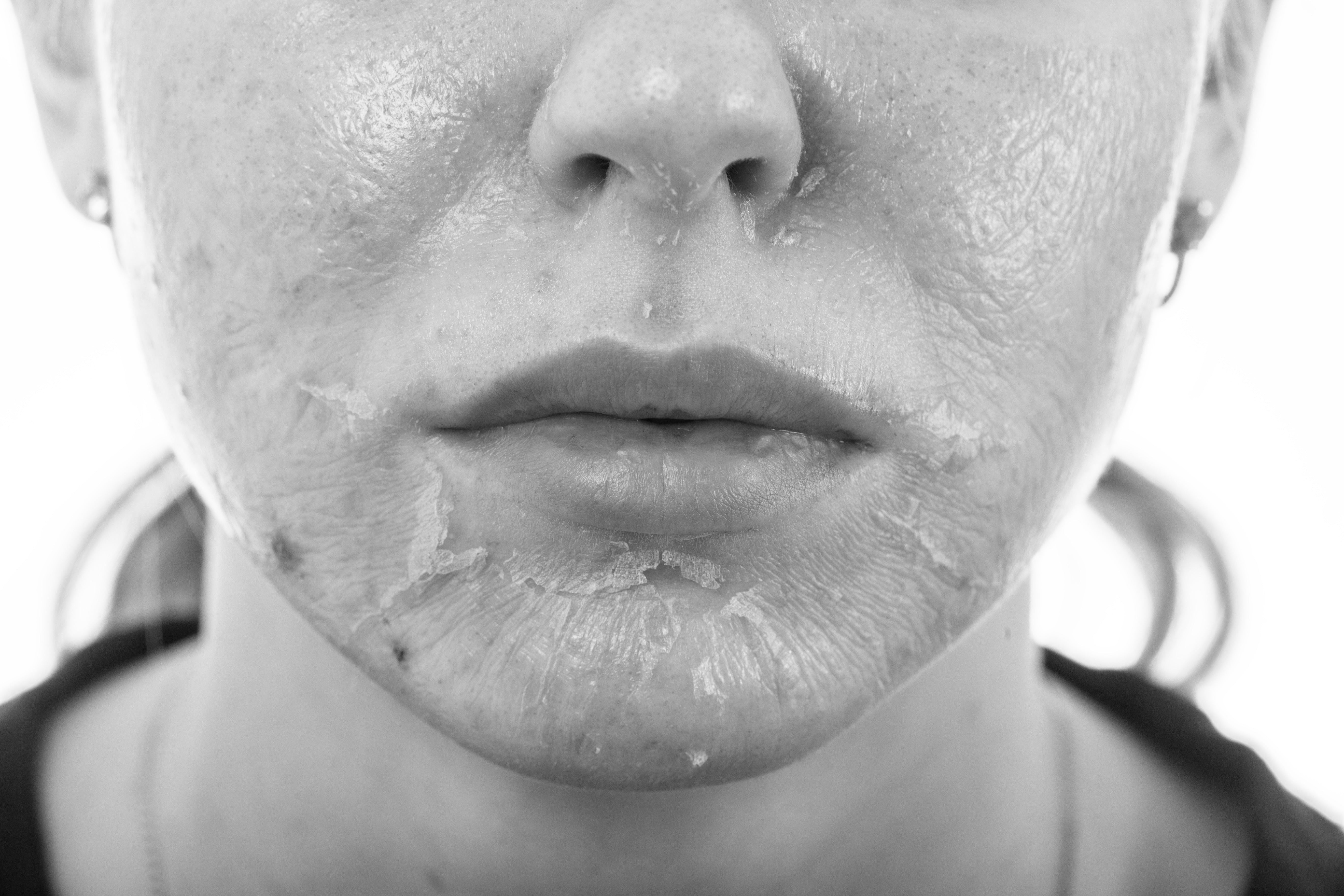 best at home facial peel