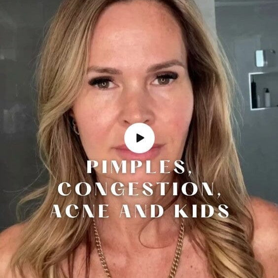 Pimples, Congestion, Acne and Kids