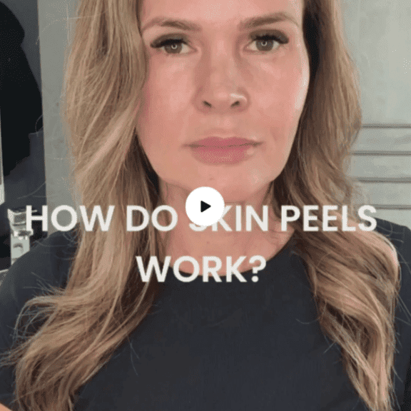 How do skin peels work?